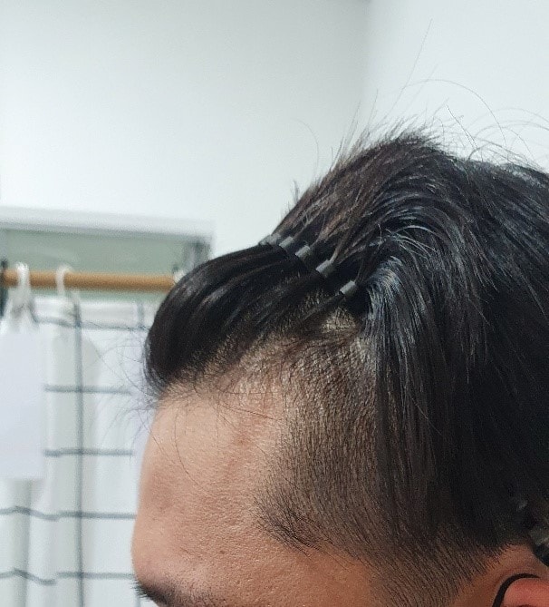 수술전2.jpg