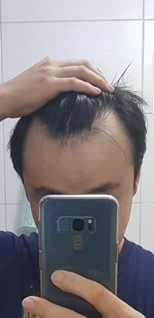 Screenshot_20181113-175344_Gallery.jpg