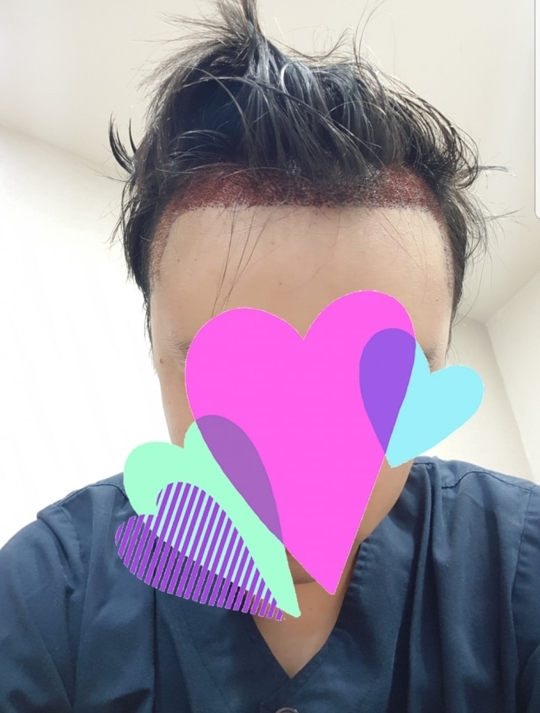 20181113_203336.jpg