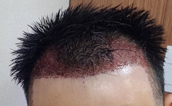 수술당일01.jpg