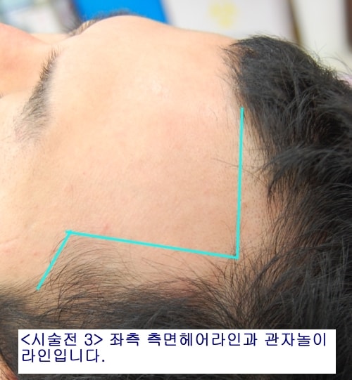 b3.jpg