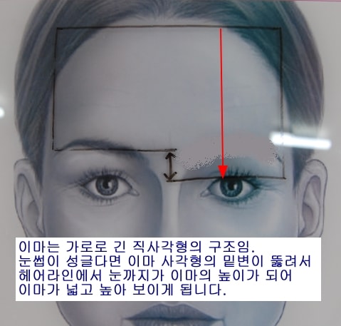 Busan Han Sang-bo Hair Graft - High forehead? Wide forehead?