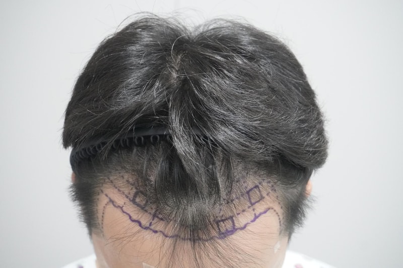 Member for Grow (formerly New Hair Busan)7It's not a commercial or a real customer review