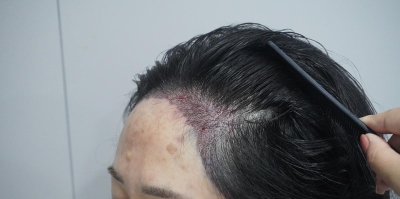 download 94.jpg