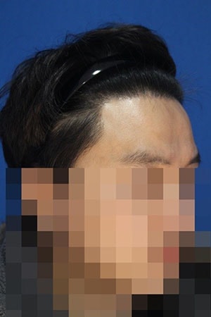 4.1년후.jpg
