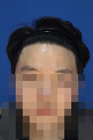 2.1년후.jpg
