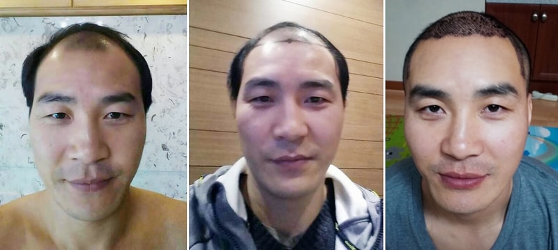 0 전후비교.jpg