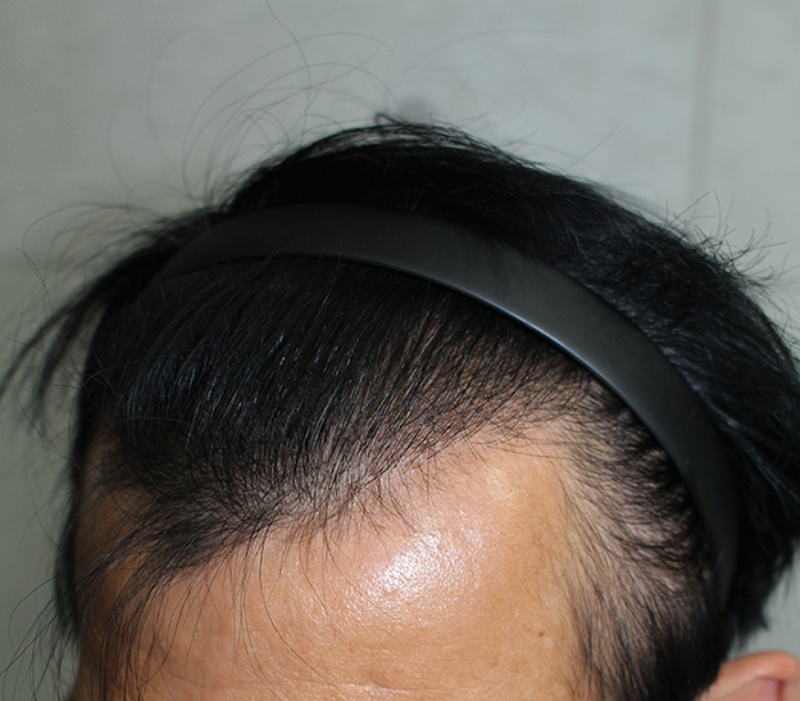 IMG_5672_1년.png