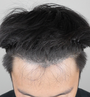 수술 후.png
