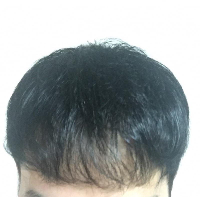 10개월.jpg