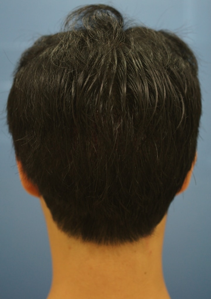 후3.JPG