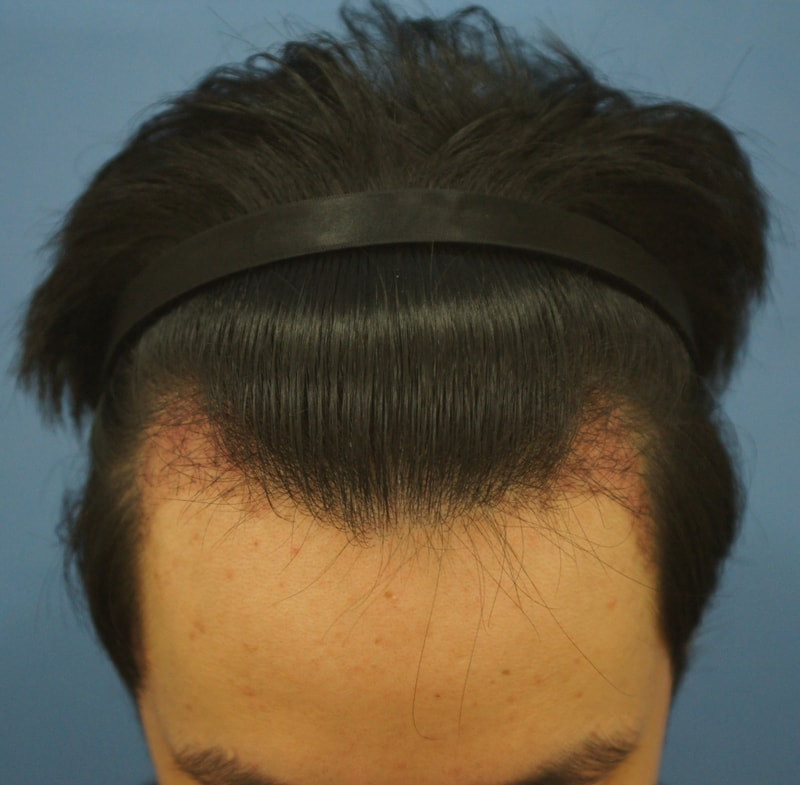 1달후1.JPG