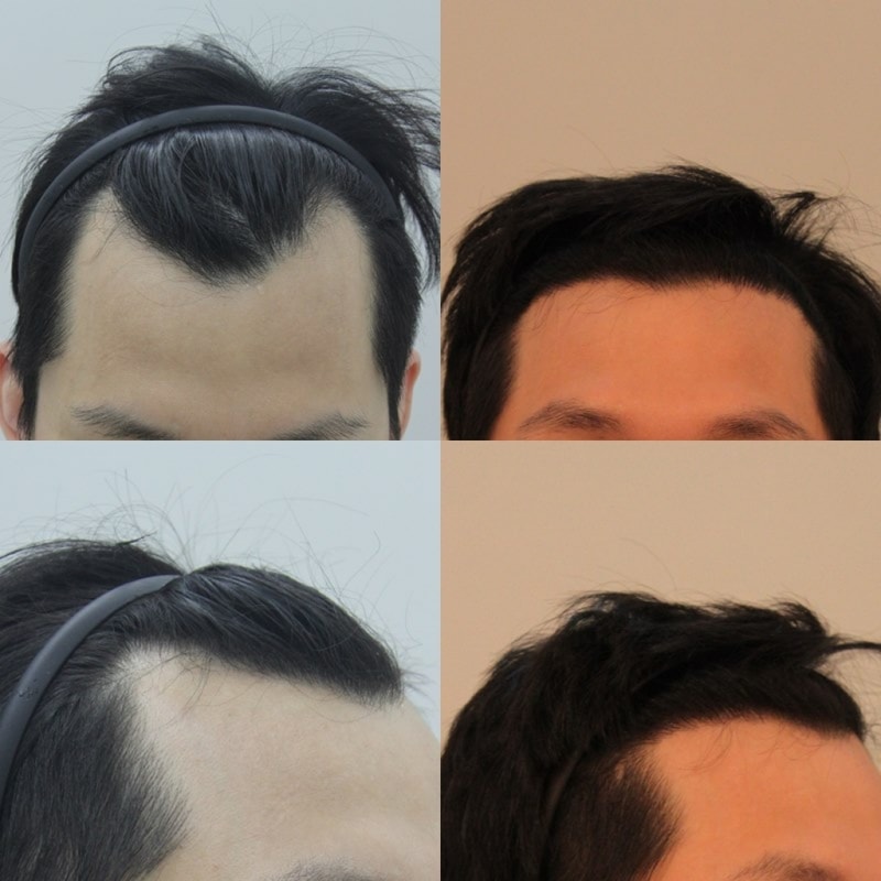 전후비교1.jpg