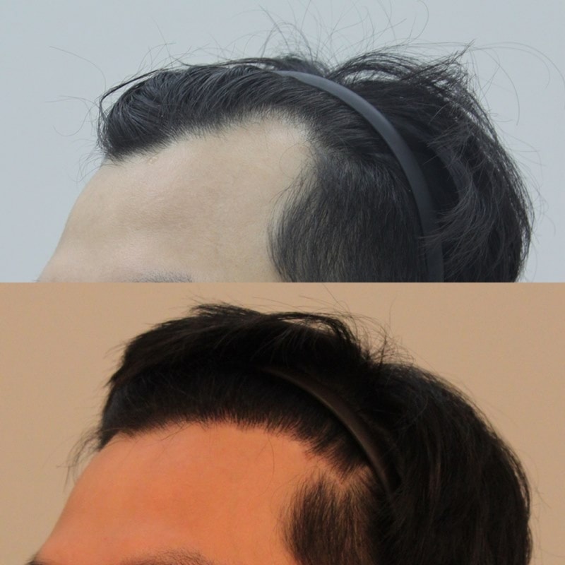전후비교2.jpg