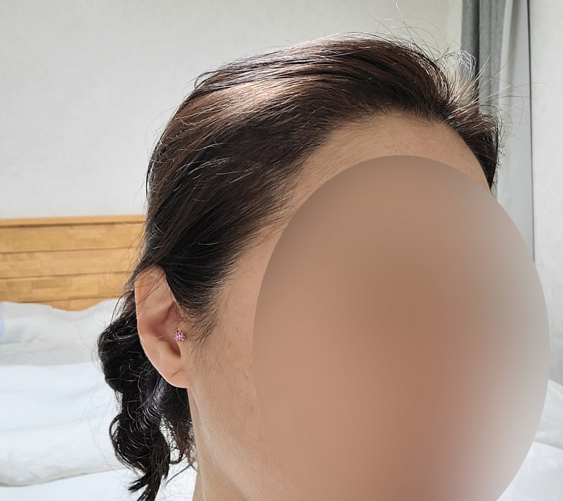 대다모 5개월 2.jpg