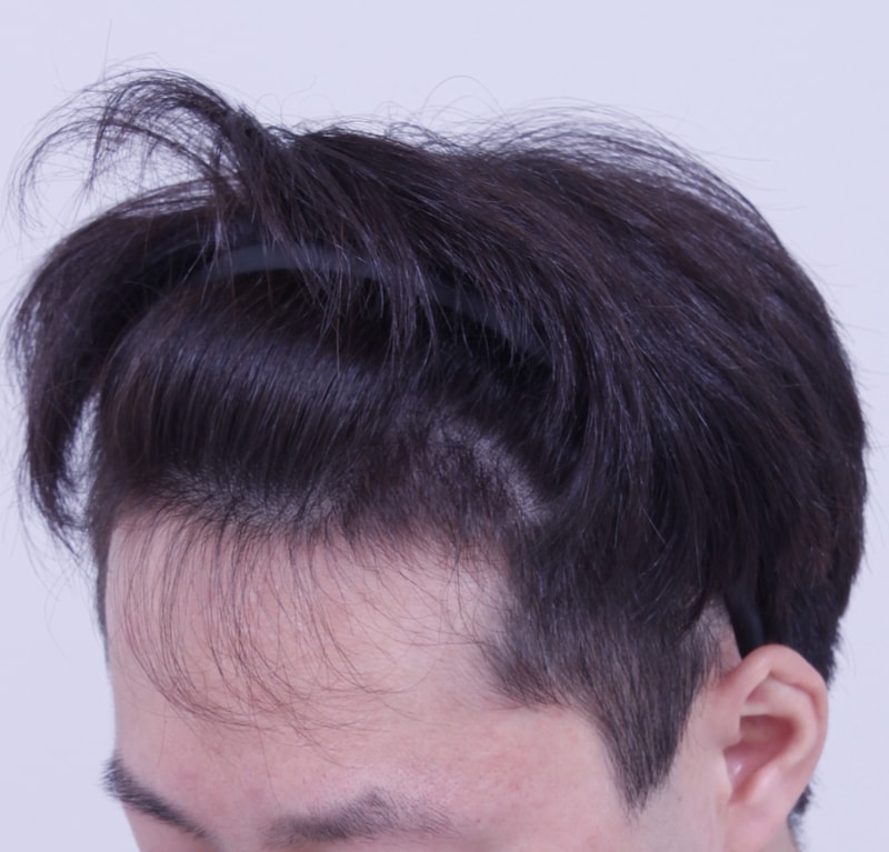 4개월2.JPG