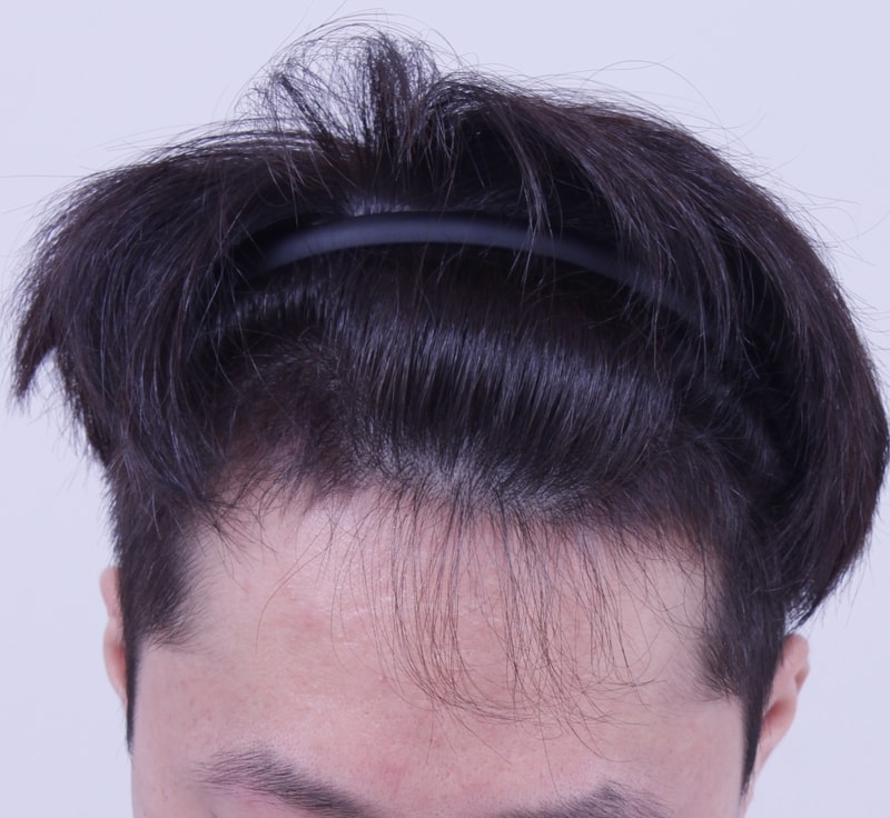 4개월1.JPG