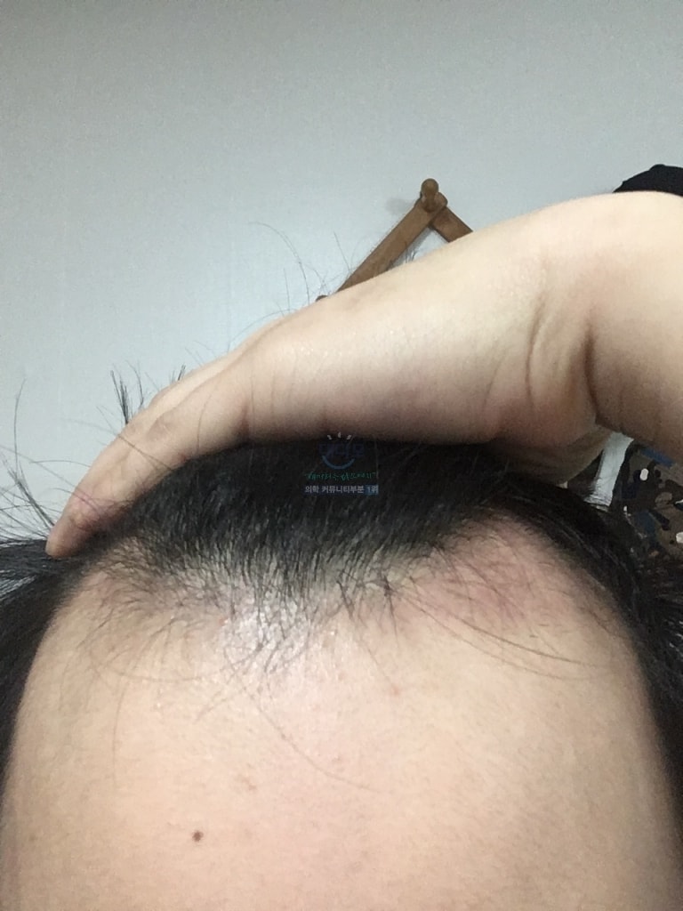 두달1.jpg