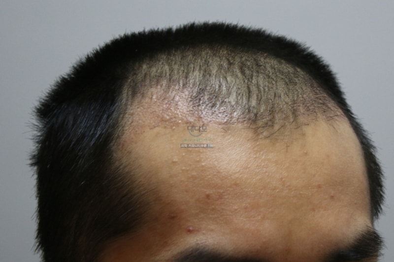 eade0fbf9dfa71f567d3b1fdb6cb6abd.jpg