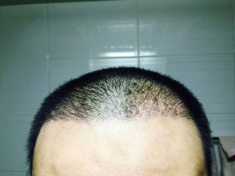 KakaoTalk_20151103_095640990.jpg