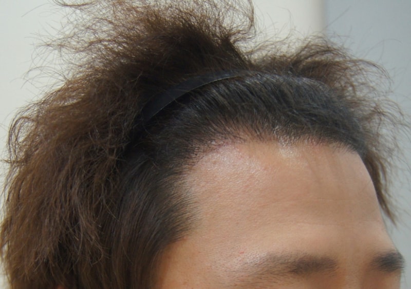 9개월(1).jpg