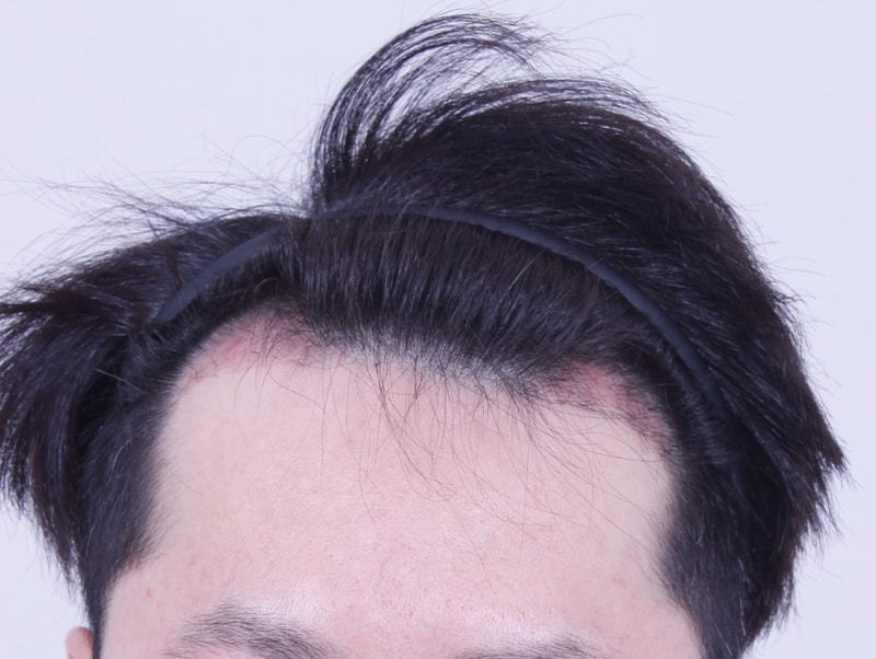 3주1.JPG