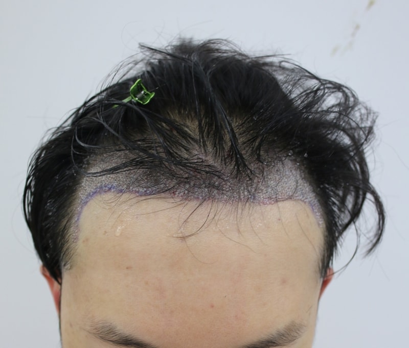 후1.JPG