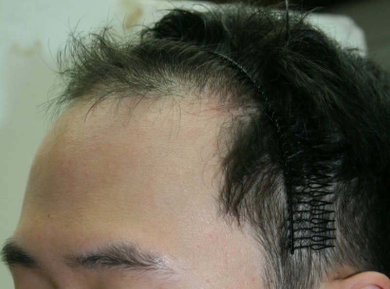 gf20150811_175024.jpg