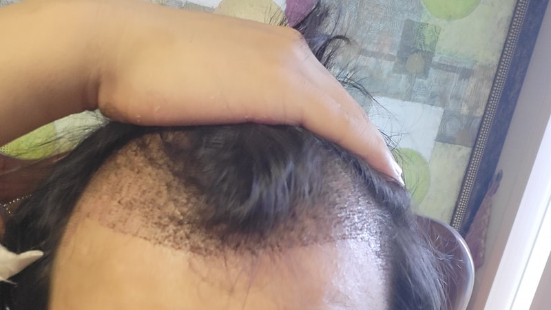 Clear Clinic Non-Cutting 4000 Mo 2 Weeks Record