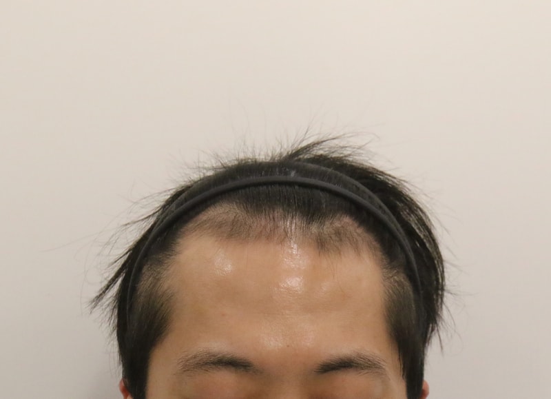 포토후기 이미지