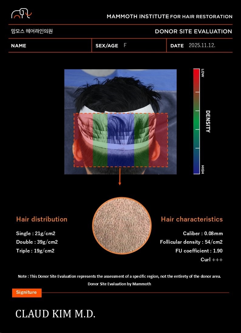 포토후기 이미지