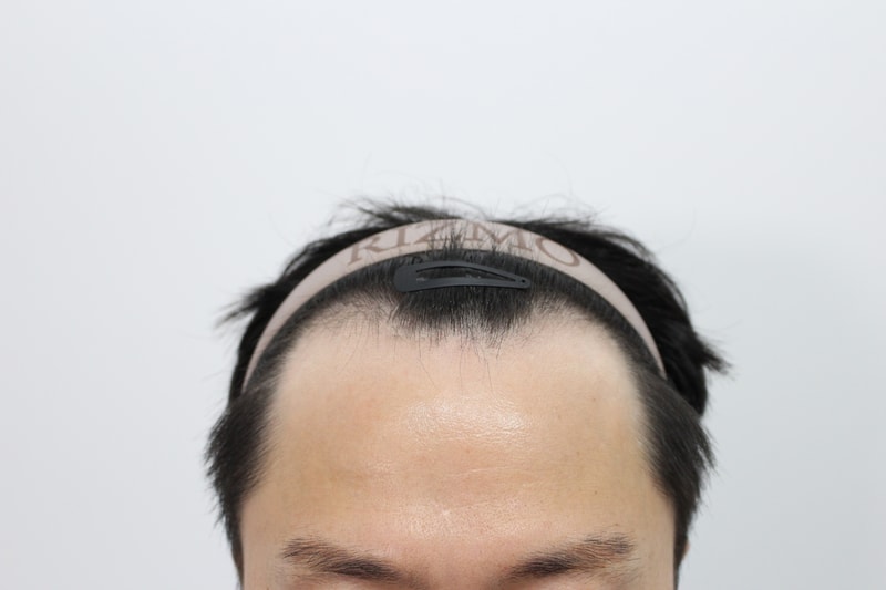 포토후기 이미지