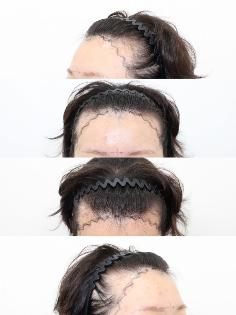 포토후기 이미지