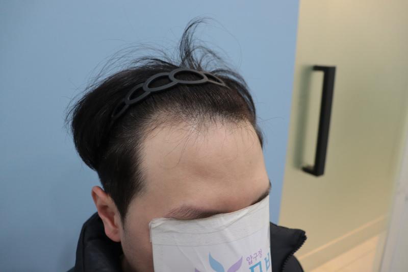 光州狎鸥亭Mobian医院经过10个月后的后记