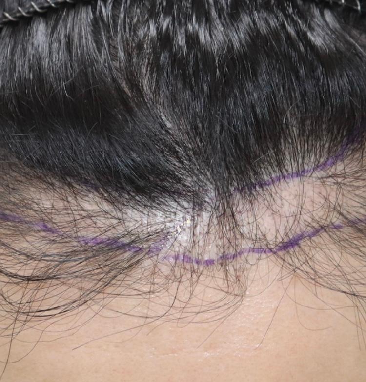 ポヘア大邱リタッチ1ヶ月目です！！