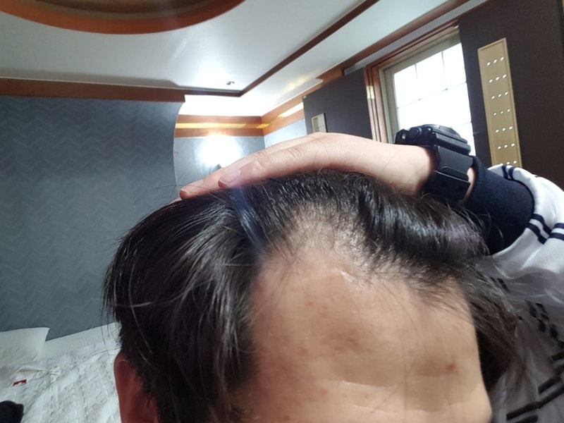 수술전전.jpg