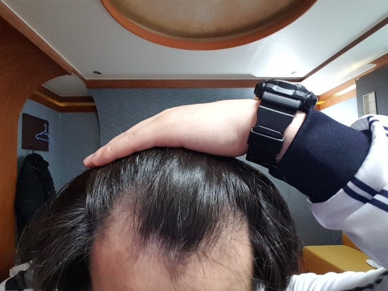 수술전.jpg