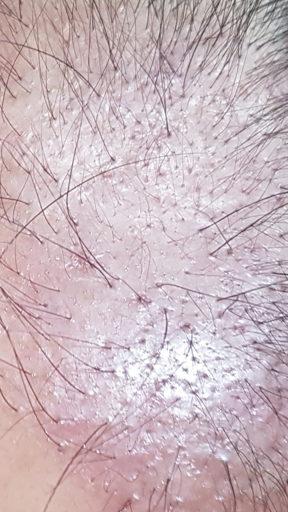 Screenshot_20190322-095359_Gallery.jpg