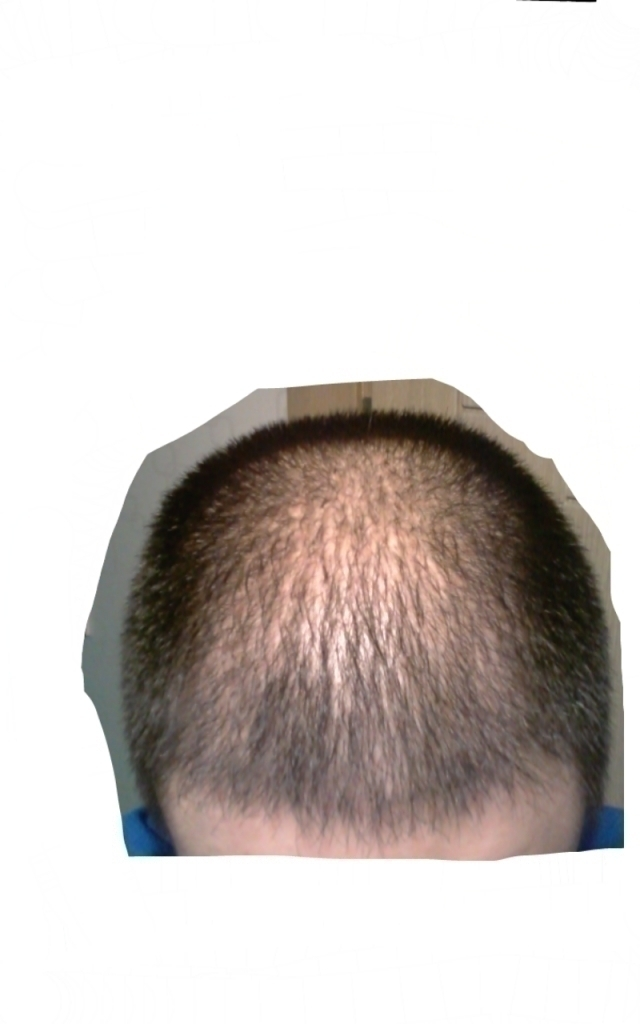 第3个月怎么样？~