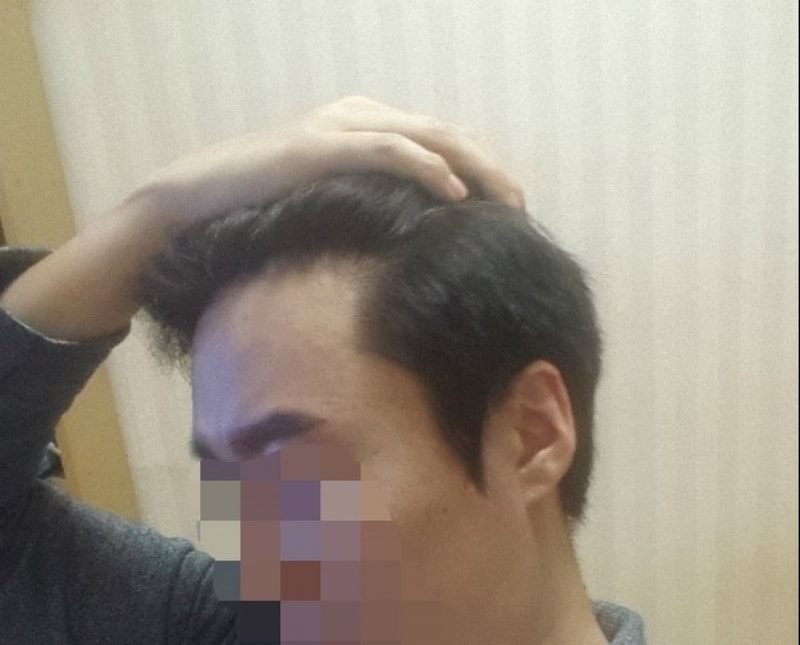 수술후2.jpg