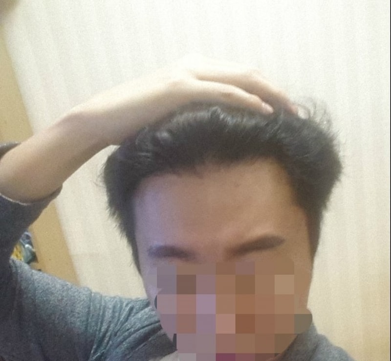 수술후1.jpg
