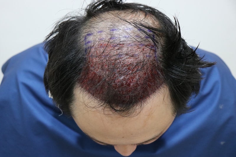 수술날 1.JPG