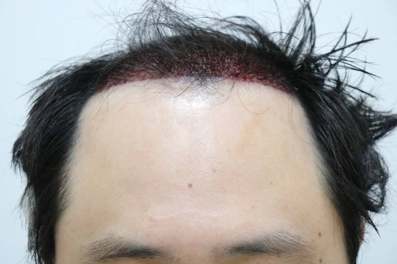 수술날 2.JPG