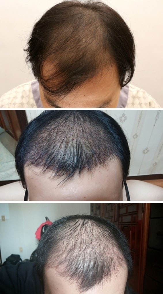 호잇.jpg