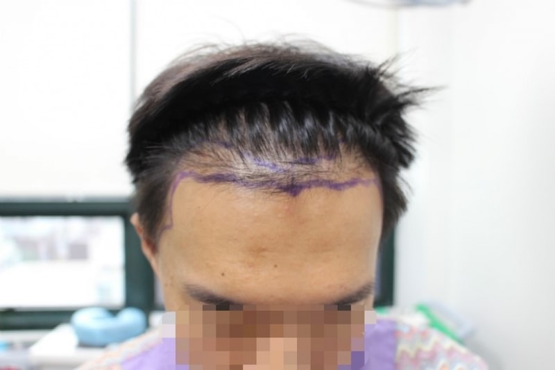 수술전사진1.jpg