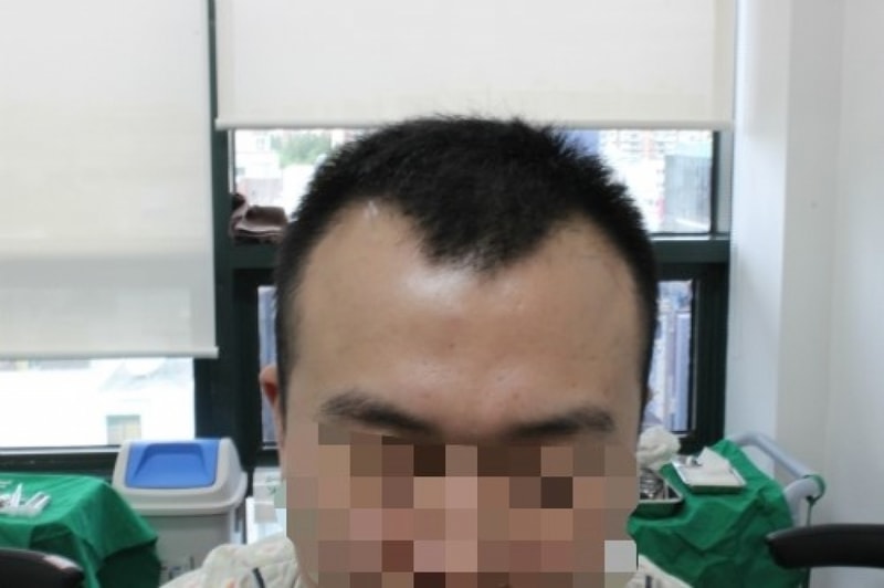 수술전2.jpg