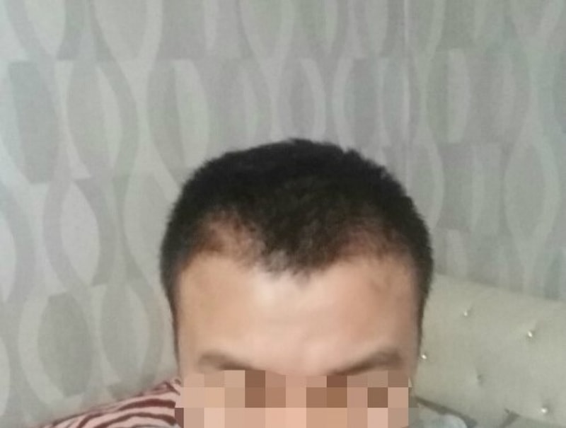 수술후2.jpg