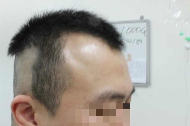 수술전1.jpg
