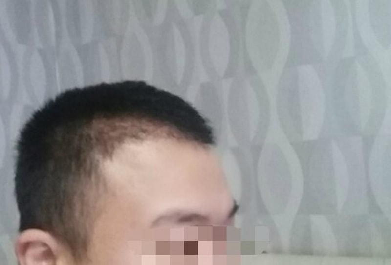 수술후1.jpg