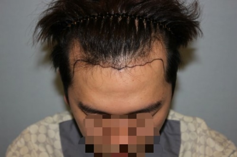 수술전1.jpg